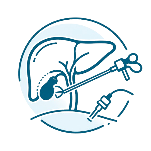 Gallbladder Removal Icon